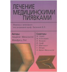 Лечение медицинскими пиявками